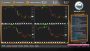 Whalepool Live Bitcoin / Cryptocurrency Trading Stream 24/7/365